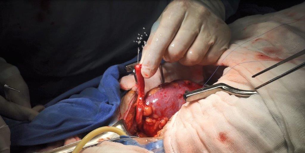 IMSS promueve la Semana Nacional de Donación de&nbsp;Órganos